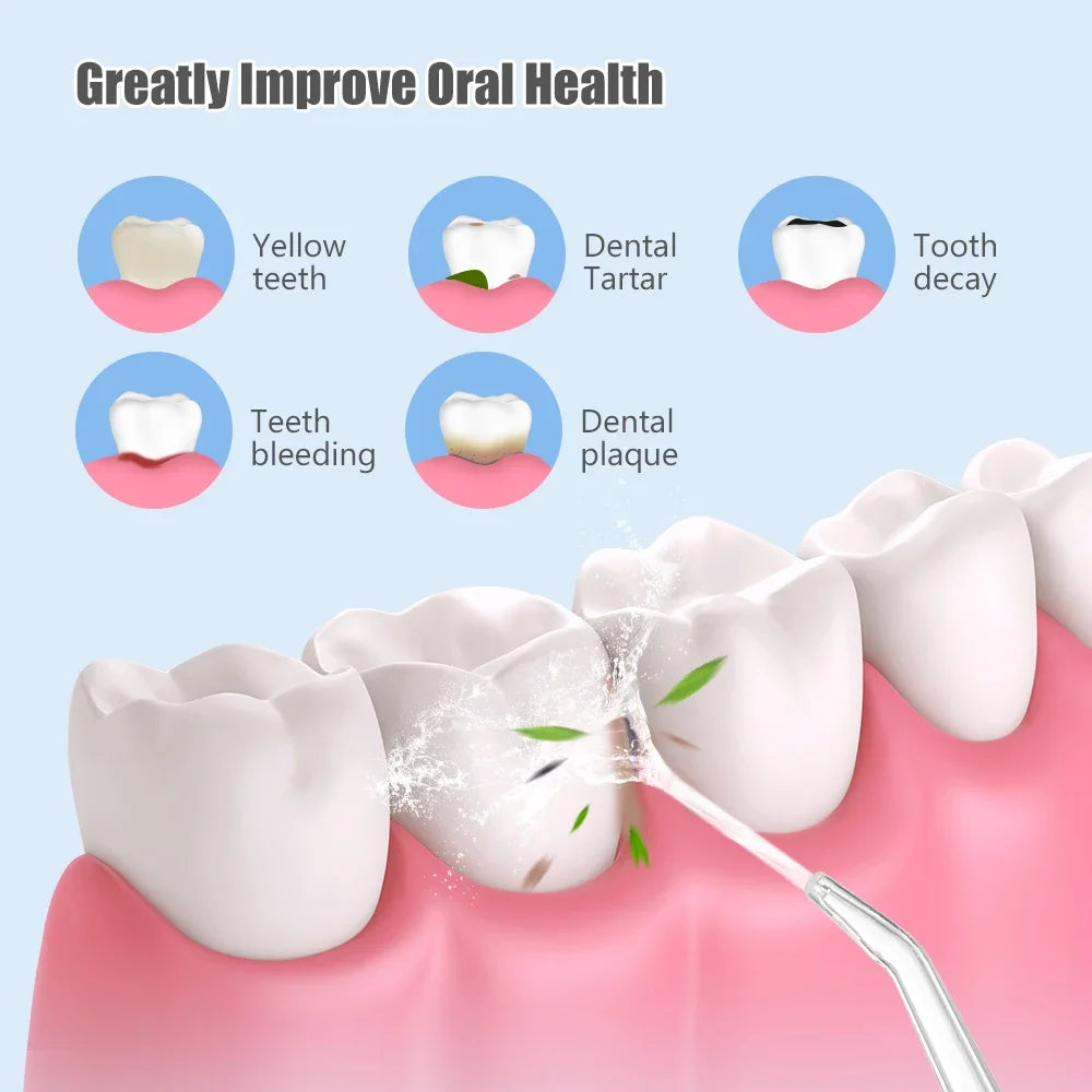 Lavadora bucal recargable por USB, irrigador portátil potente, chorro de agua Dental, 3 modos, 4 chorros para limpieza de dientes